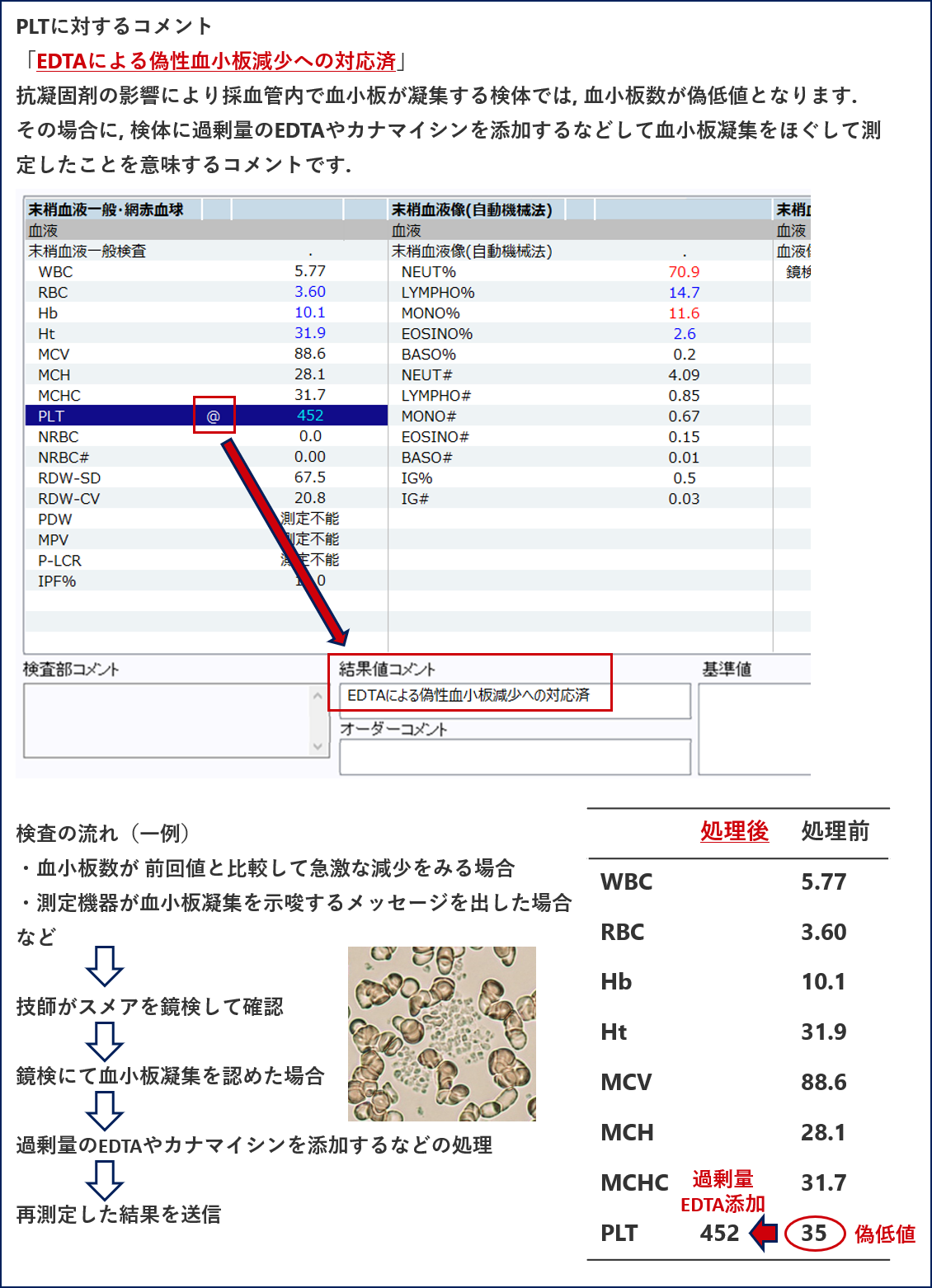 @コメントの意義<br />「EDTAによる偽性血小板減少への対応済」